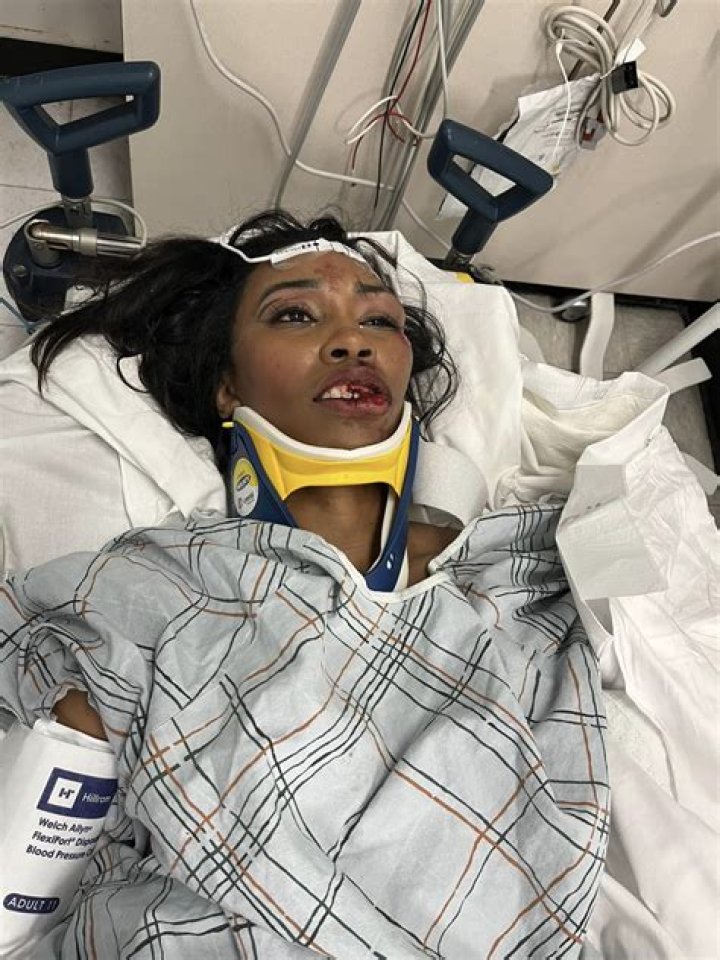 Carrie Bernans seriously injured in 'hit-and-run' accident months after giving birth