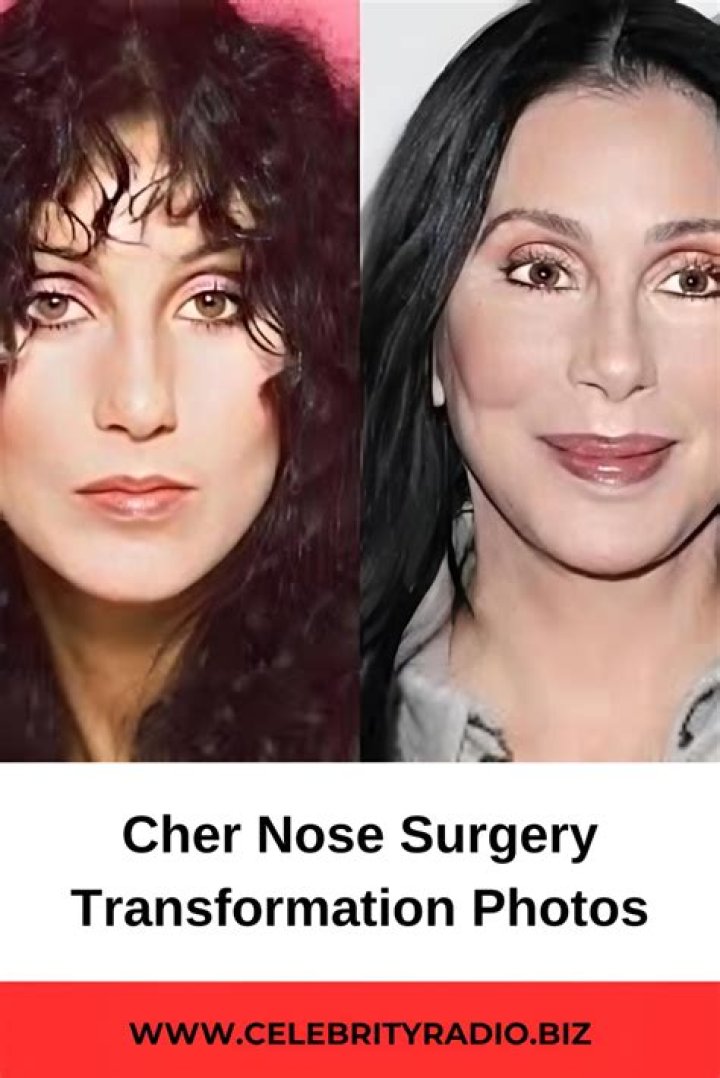 Five Cher Plastic Surgery Jokes on Twitter That Even Cher Would Like