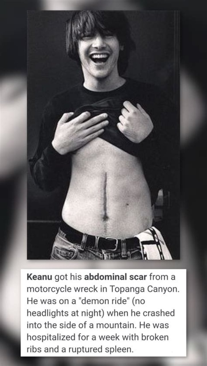 Terrifying Story Behind Keanu Reeves' Stomach Scar